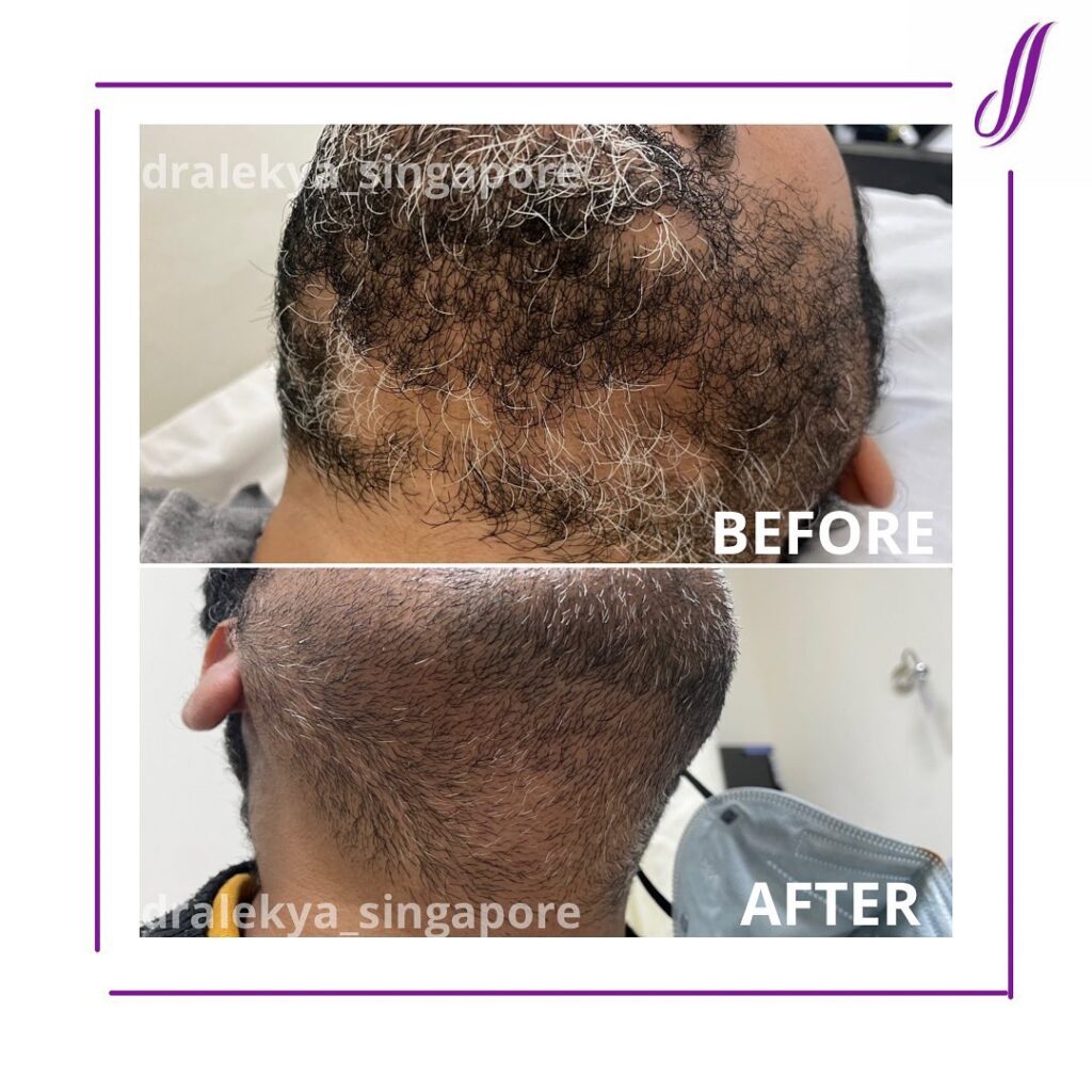 The Skin Sensé by Dr Alekya Singapore