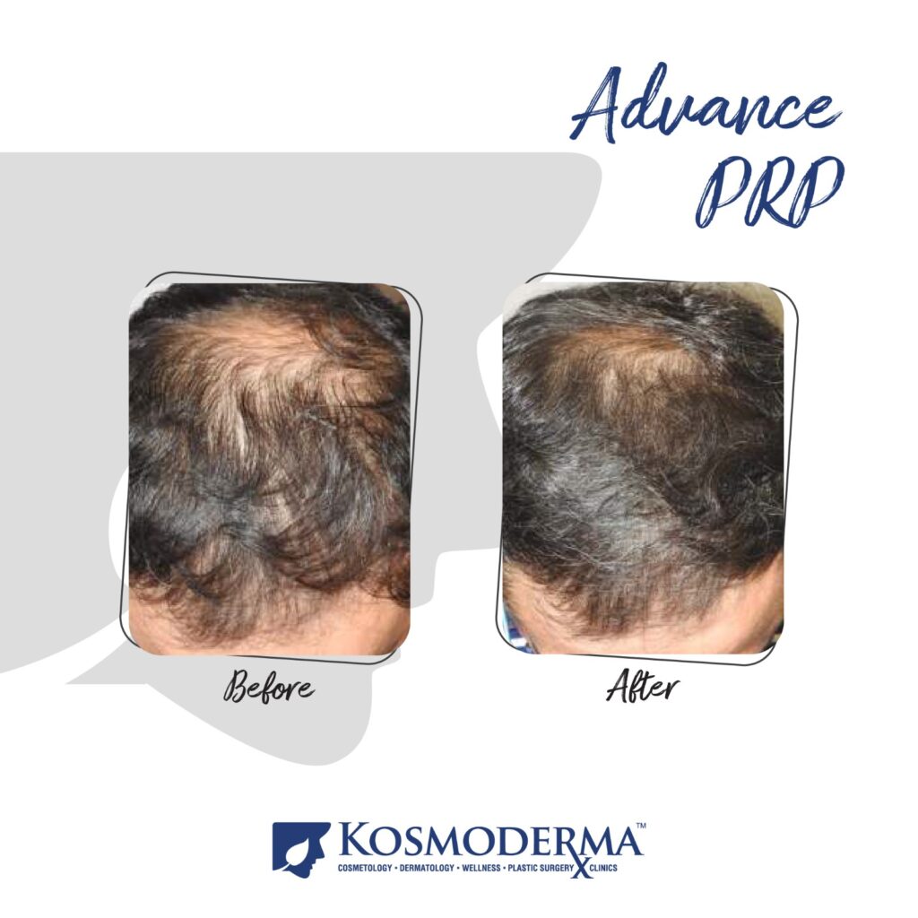 Kosmoderma Healthcare