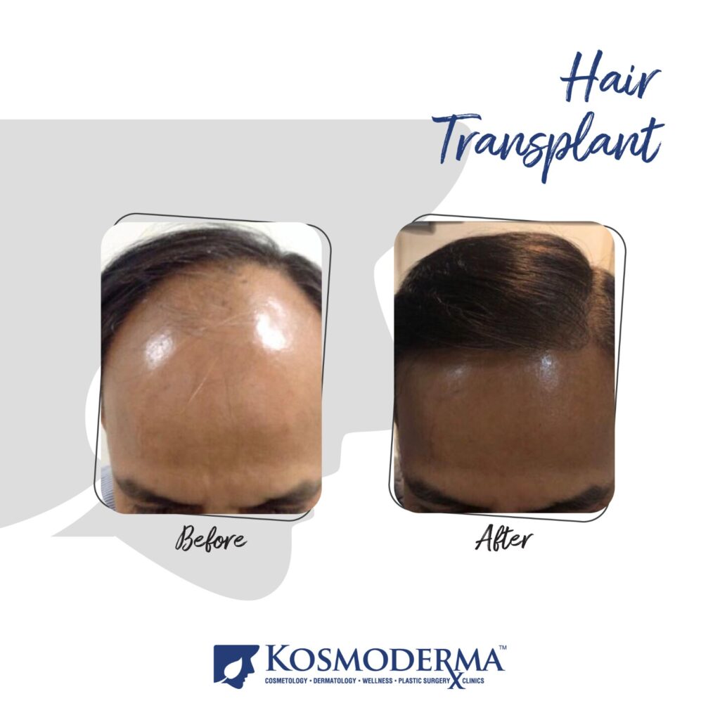 Kosmoderma Healthcare