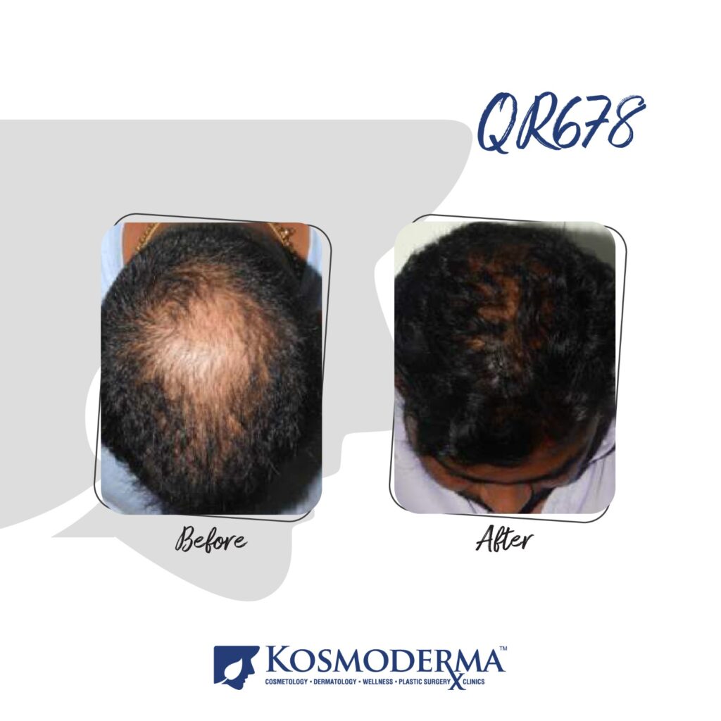 Kosmoderma Healthcare