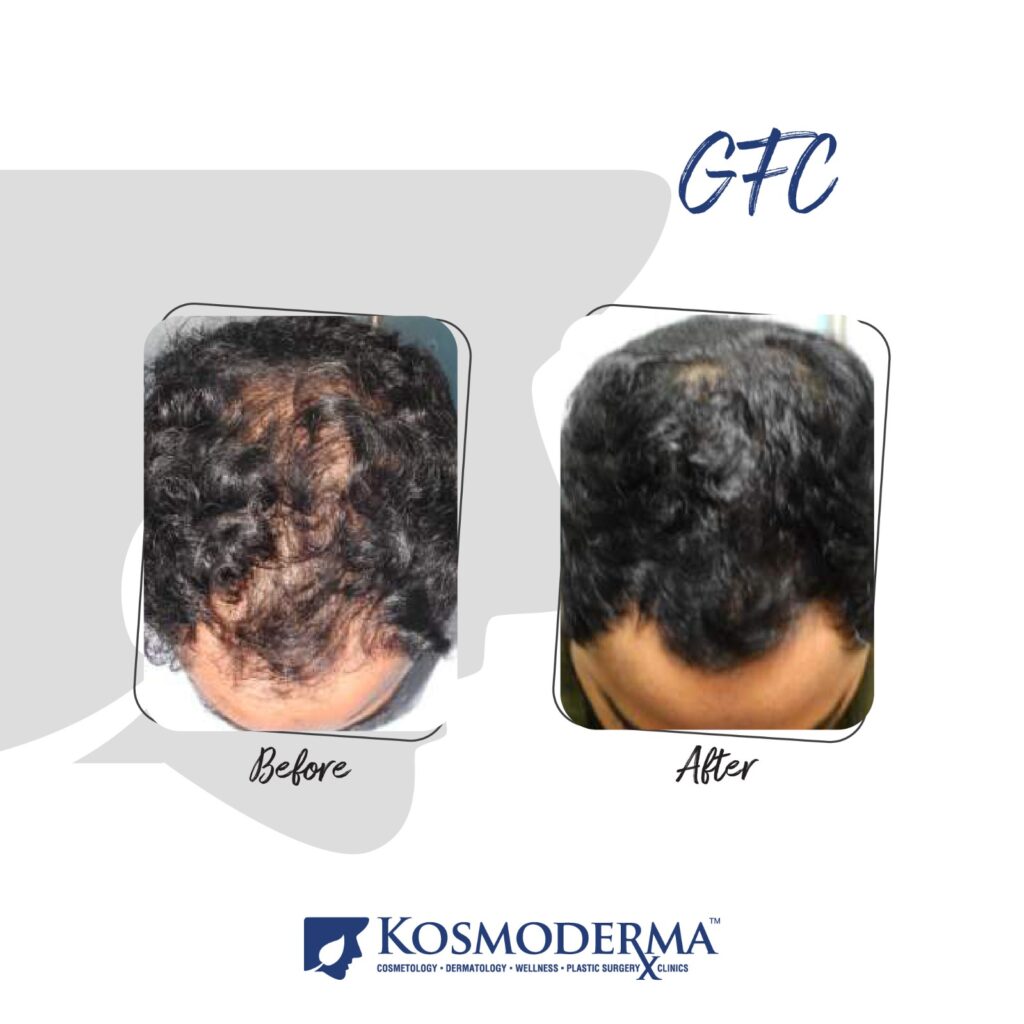 Kosmoderma Healthcare