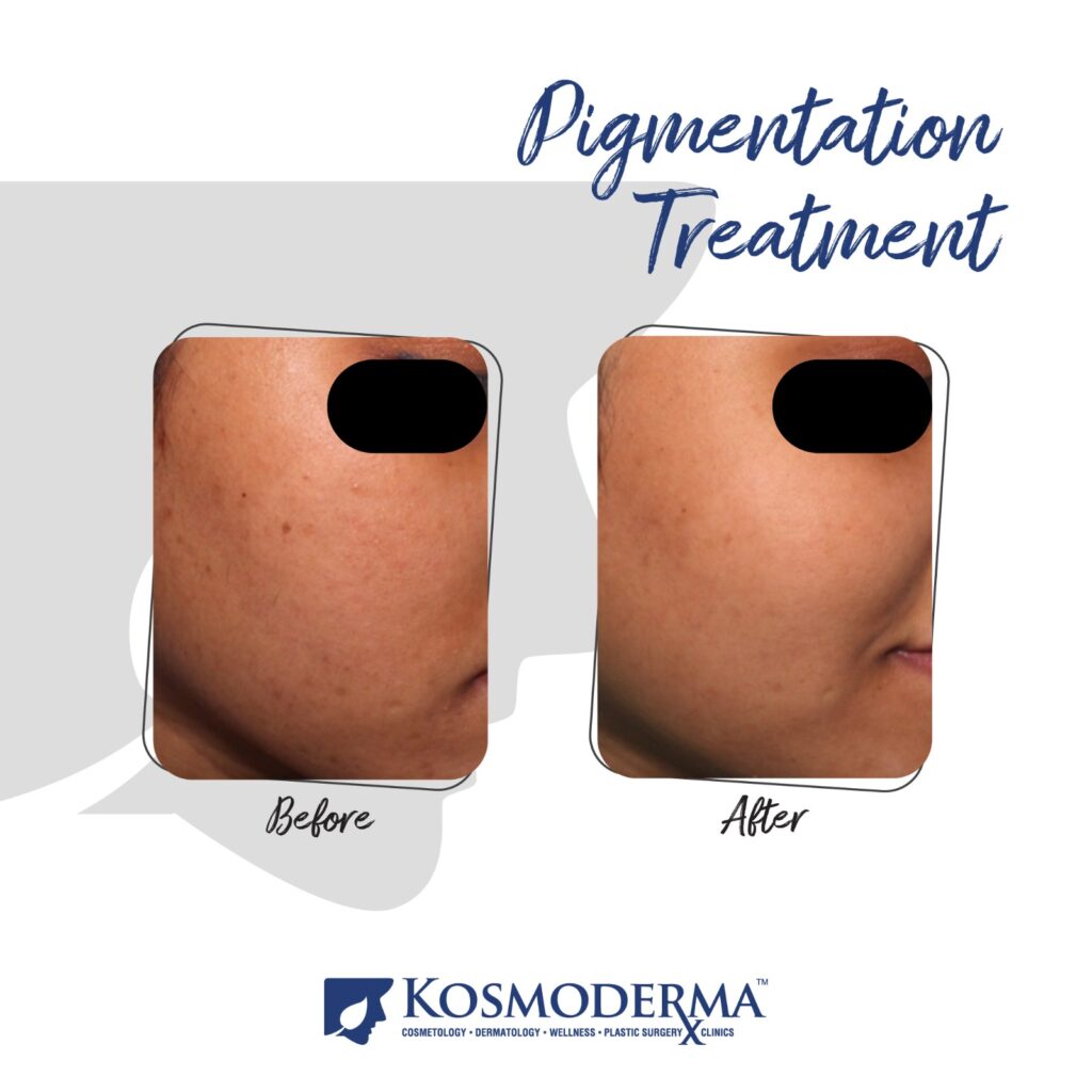 Kosmoderma Healthcare