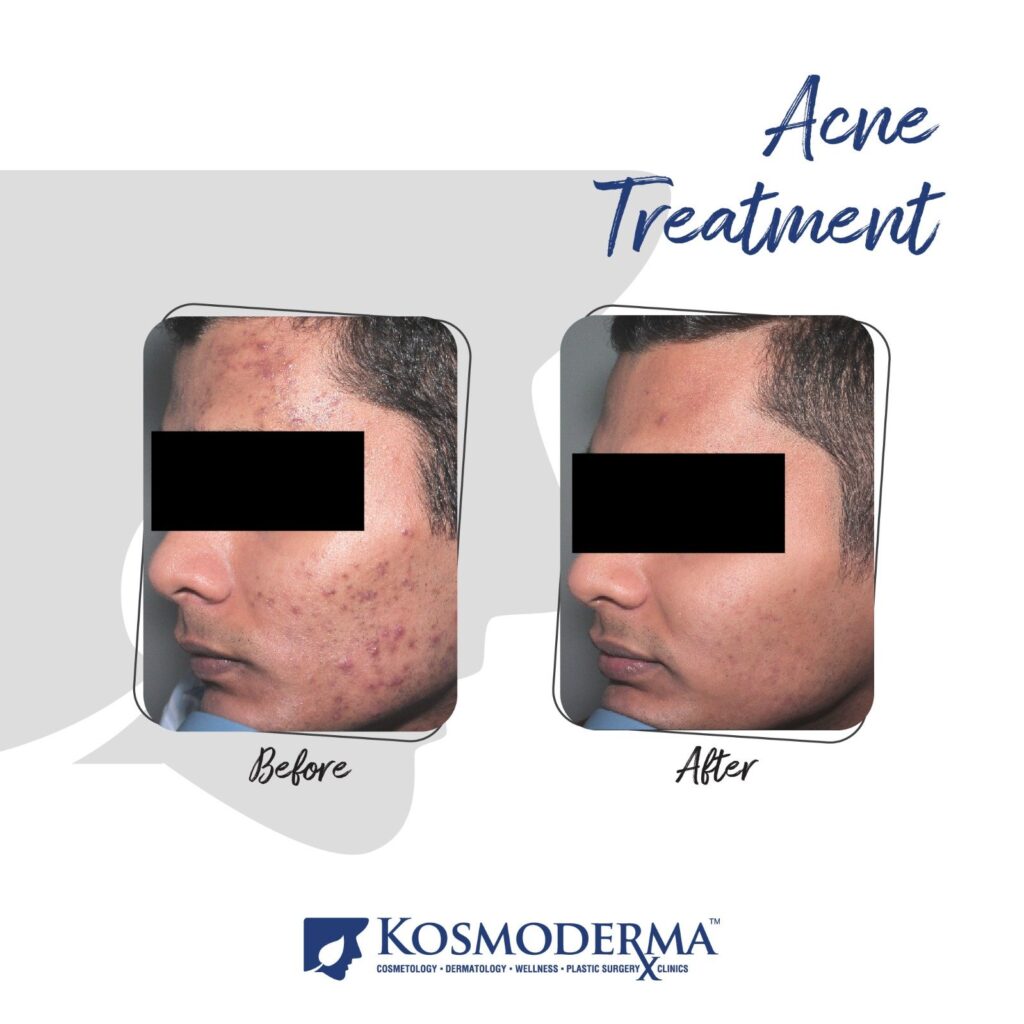 Kosmoderma Healthcare