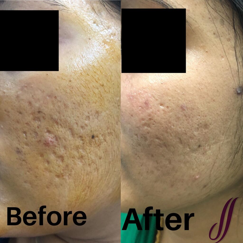 The Skin Sensé by Dr Alekya Singapore