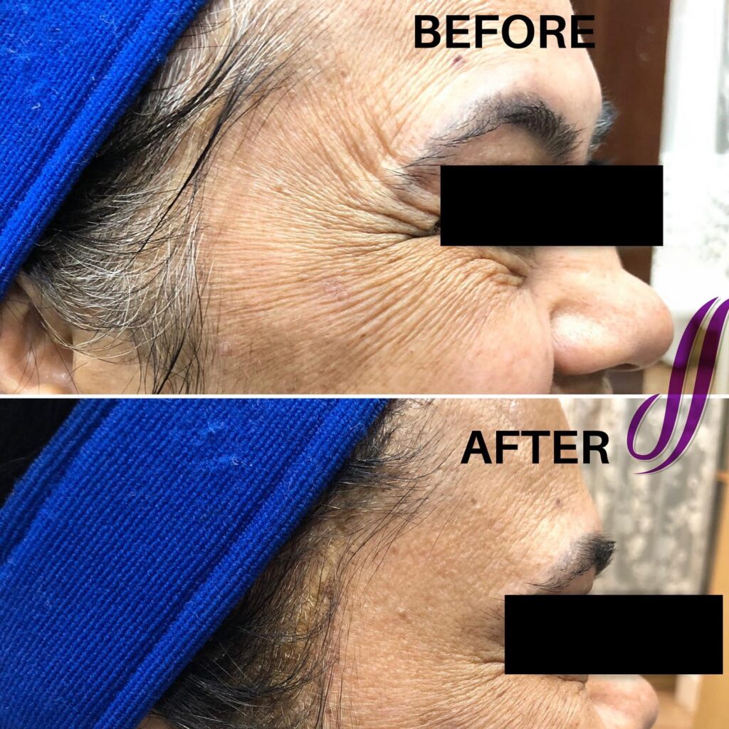 The Skin Sensé by Dr Alekya Singapore