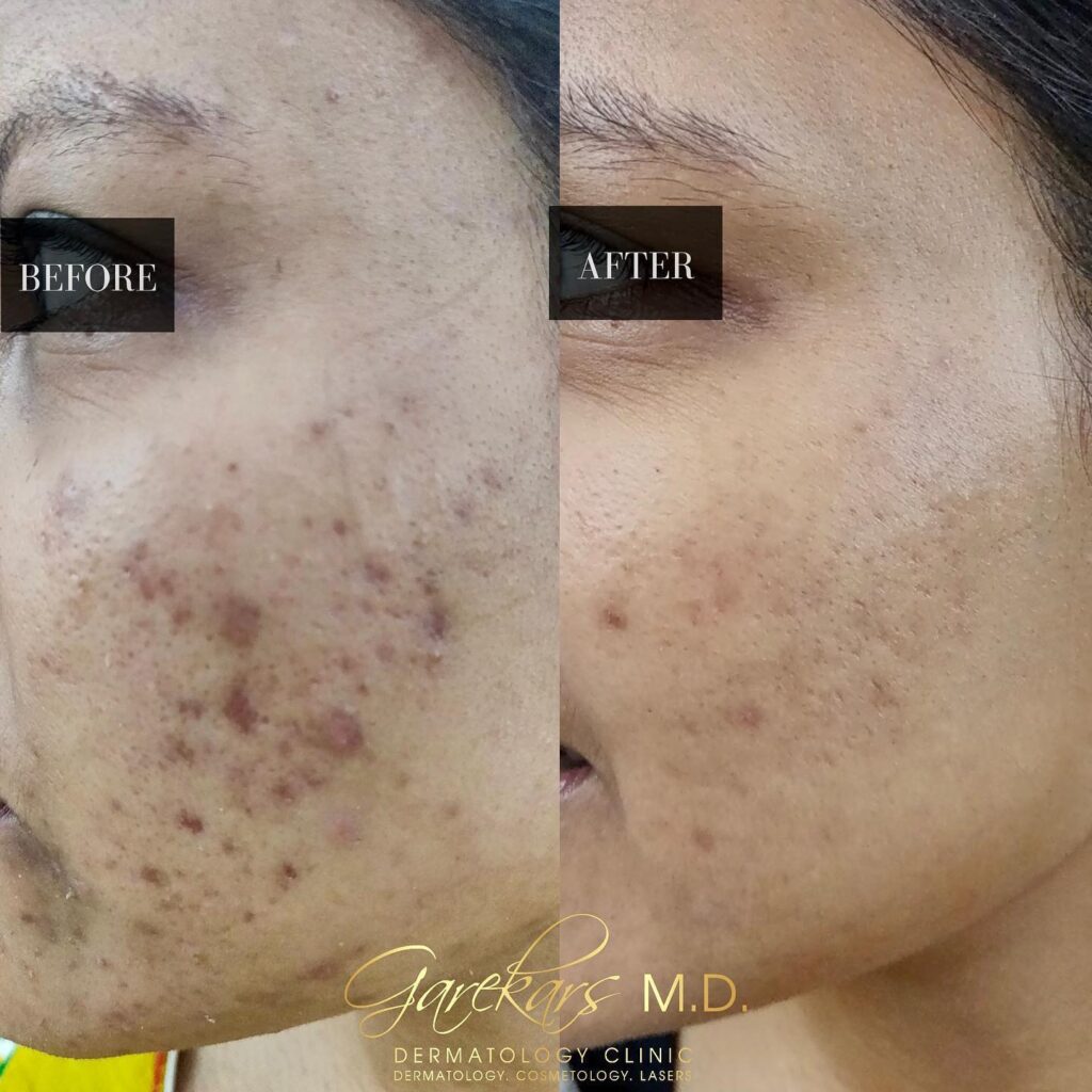Garekars M.D. Dermatology Clinic