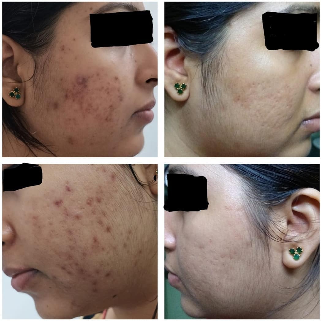Dr. Dipali's Lavish Skin Aesthetic & Laser Clinic