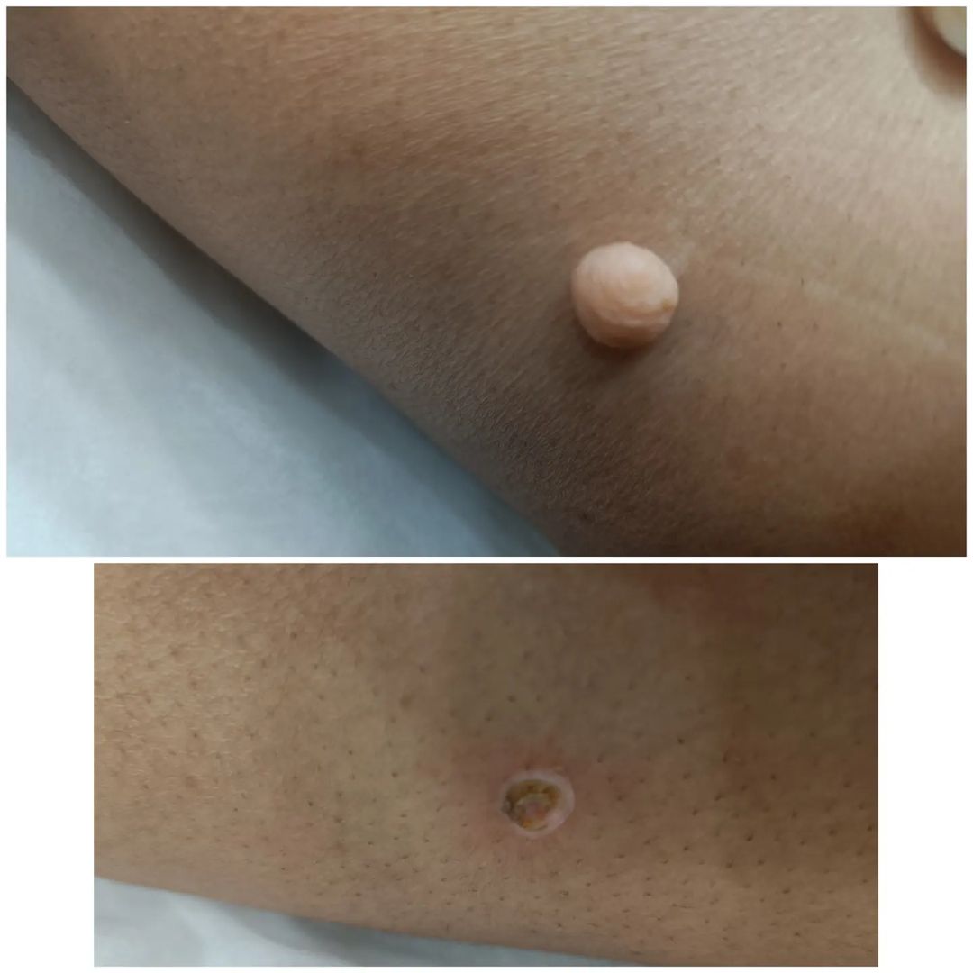 Dr. Dipali's Lavish Skin Aesthetic & Laser Clinic